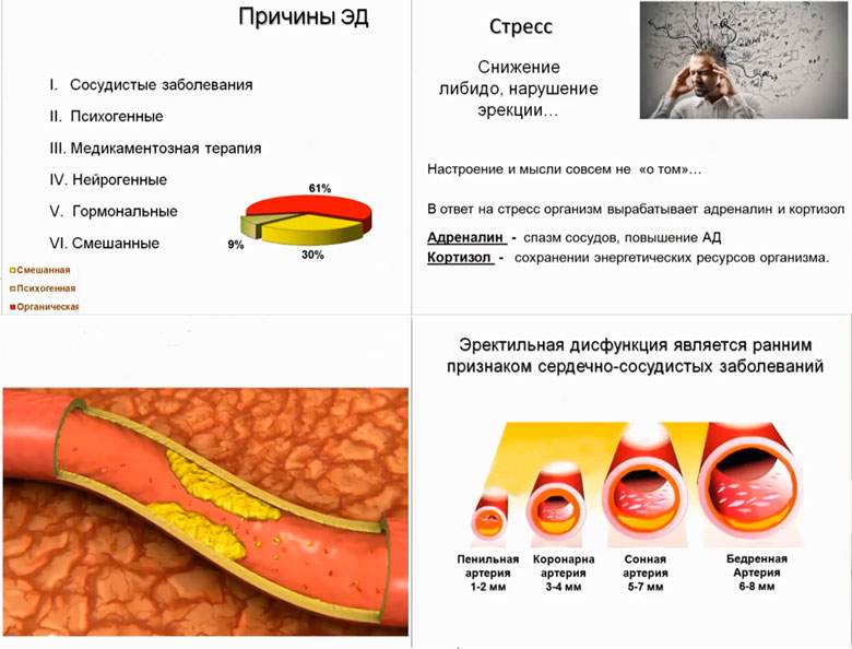 таблетки для улучшения эрекции таблетки для улучшения эрекции
